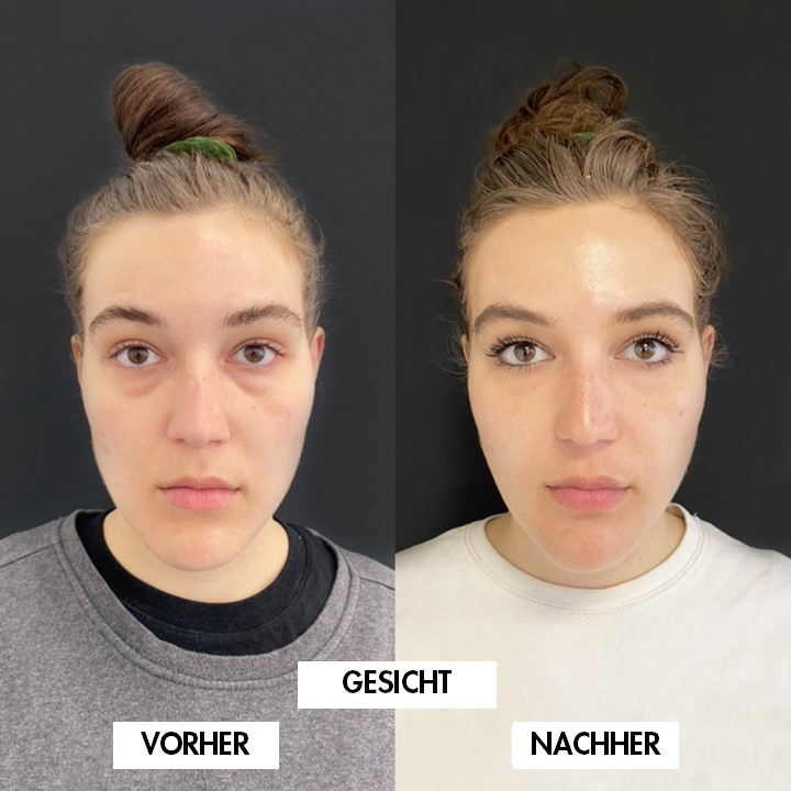 Vergleichsbild 1: VORHER links, NACHHER rechts