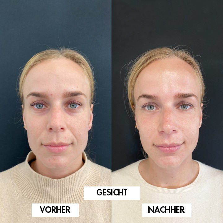Vergleichsbild 2: VORHER links, NACHHER rechts