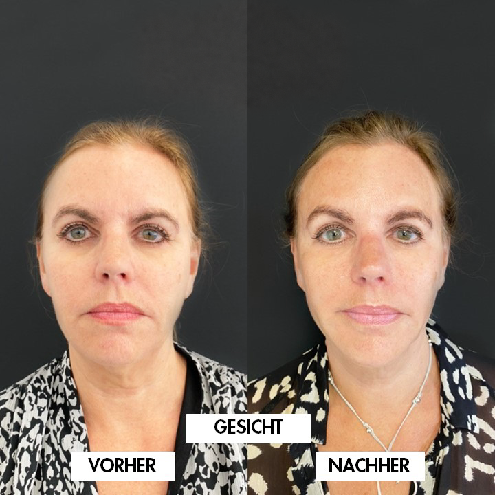 Vergleichsbild 3: VORHER links, NACHHER rechts